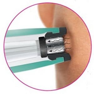 Silk'n Revit Microdermoabrasione