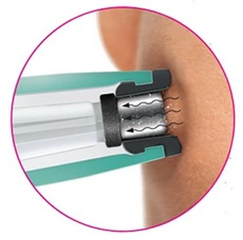 Silk'n Revit Microdermoabrasione