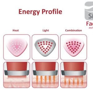 Silk'n Bellissima IMETEC FX Reju