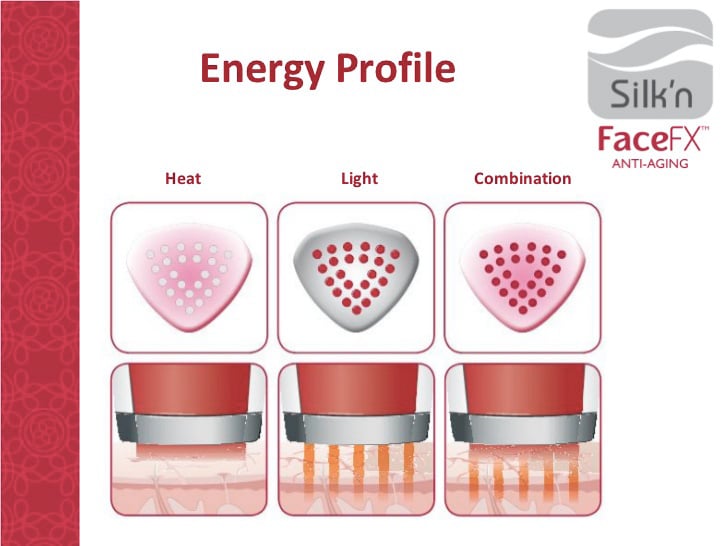 Silk'n Bellissima IMETEC FX Reju