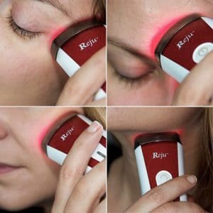 Silk'n Bellissima IMETEC FX Reju