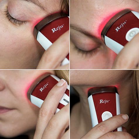 Silk'n Bellissima IMETEC FX Reju